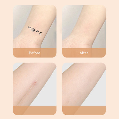 Ultra-Thin Tattoo and Scar Concealer Patch